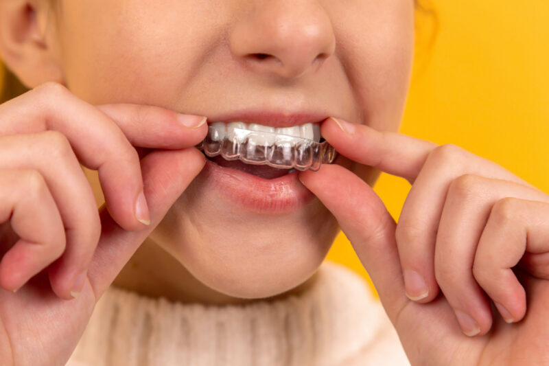 Transforming Your Smile: A Guide to Teeth Straightening Options