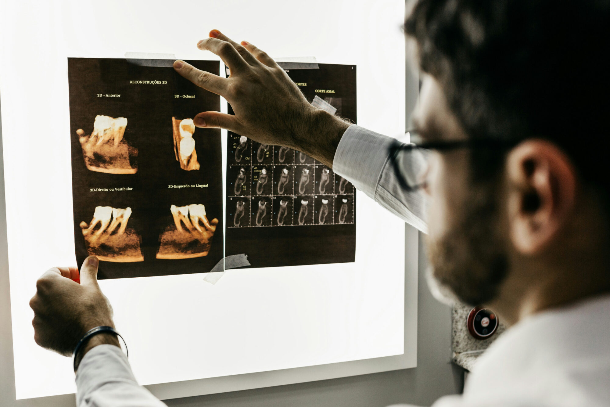 dental x-rays