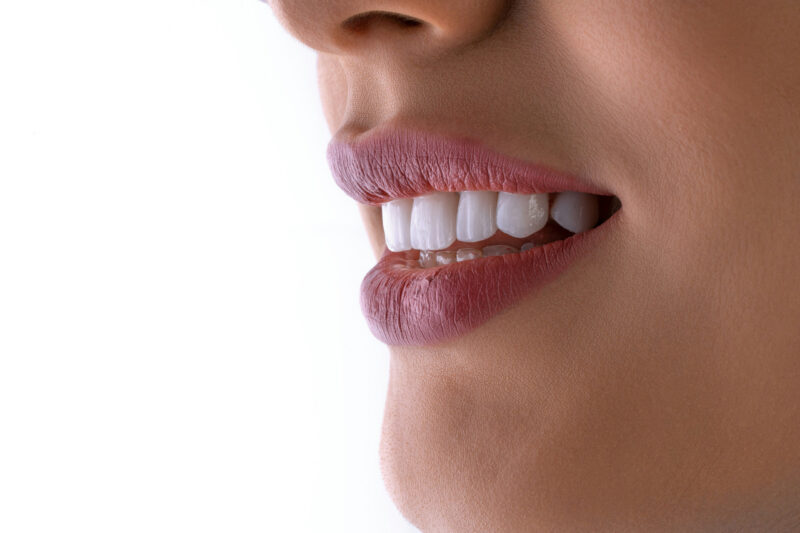 Maintaining a Perfect Smile With a Dental Retainer